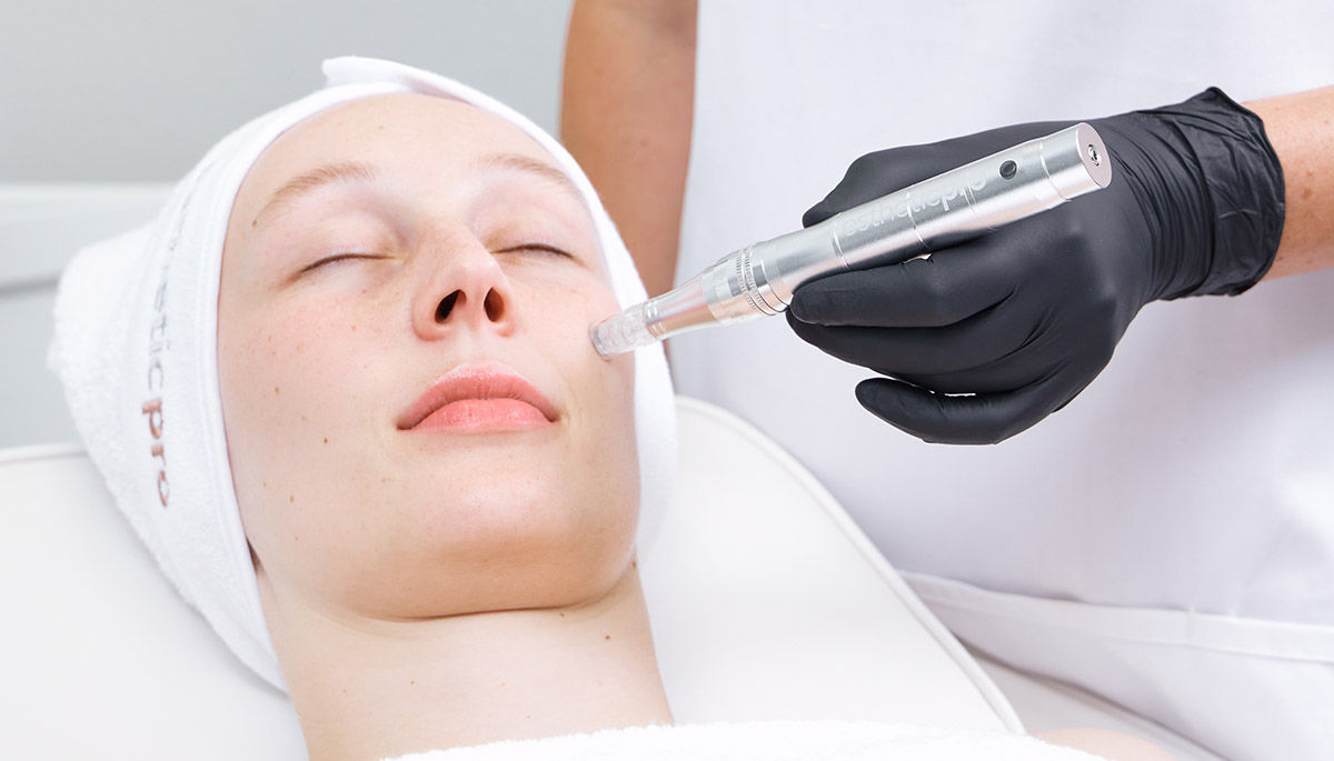 Esthetic Pro's microneedling pen