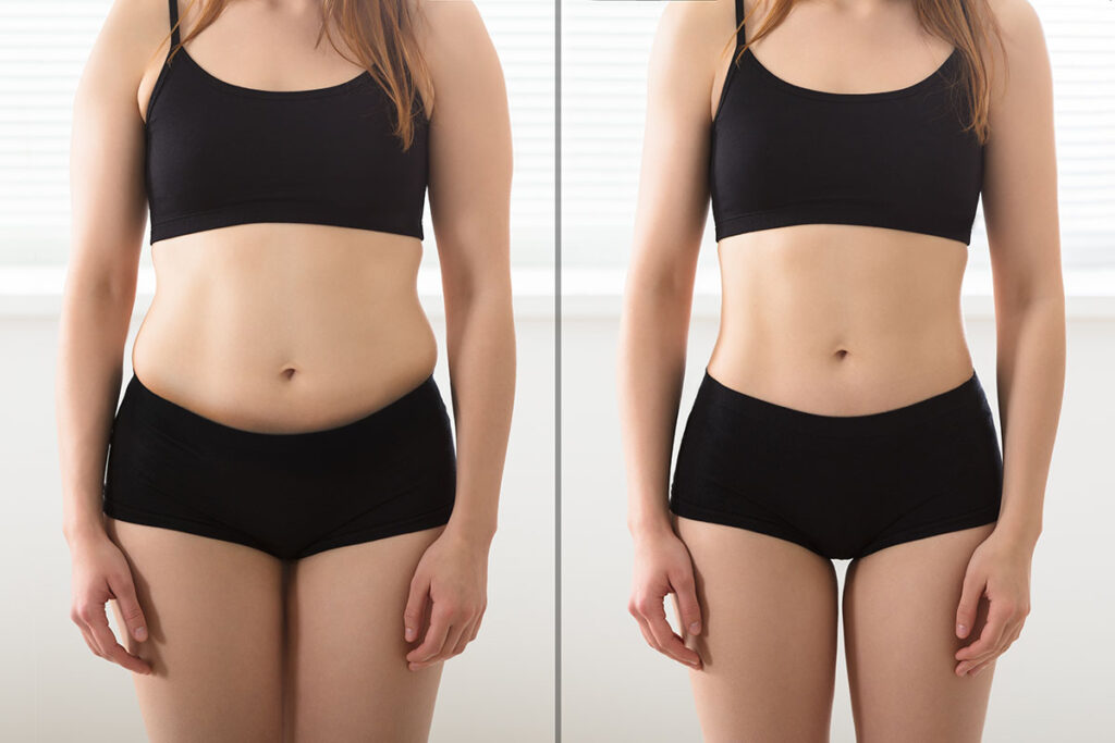 Body Shaping Vs Body Slimming: Are They The Same?