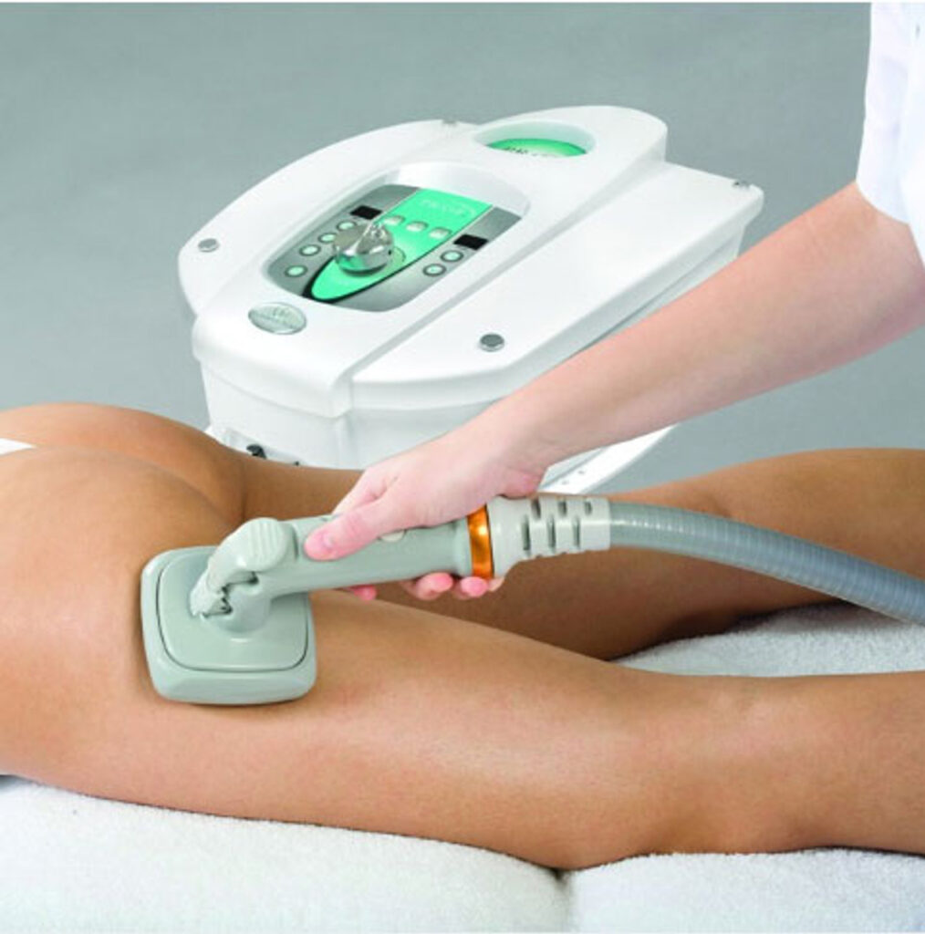 A person receiving a body sculpting treatment on their thighs with a handheld device connected to a machine.